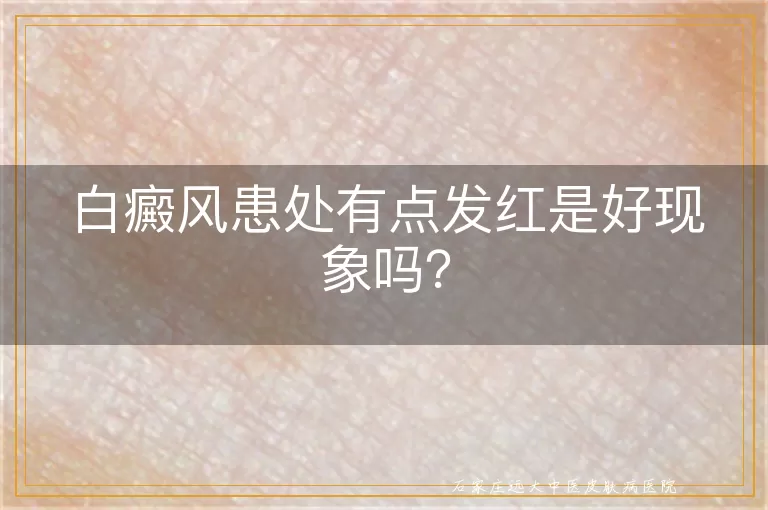 白癜风患处有点发红是好现象吗？