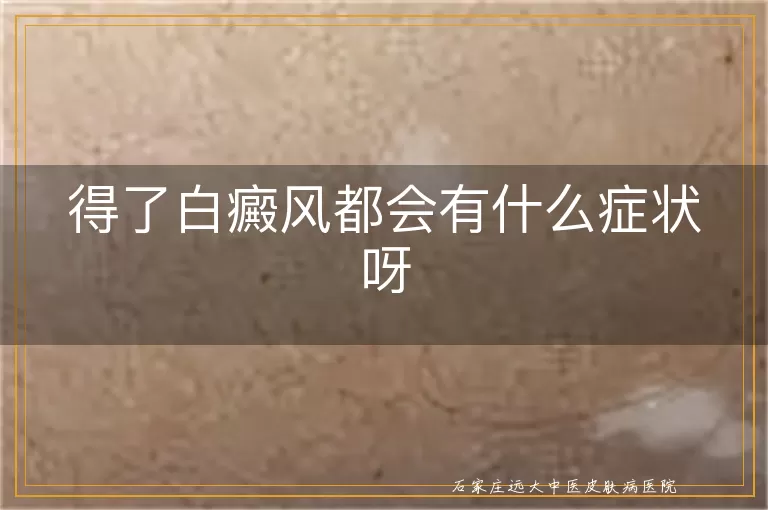 得了白癜风都会有什么症状呀