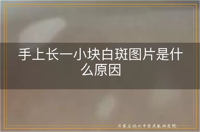 手上长一小块白斑图片是什么原因