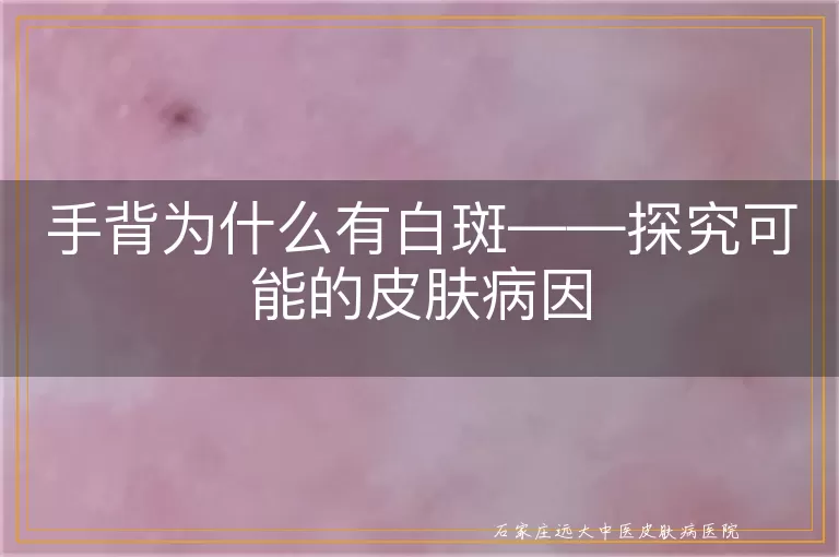 手背为什么有白斑——探究可能的皮肤病因