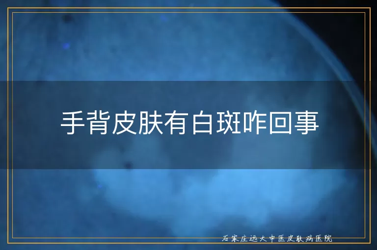 手背皮肤有白斑咋回事