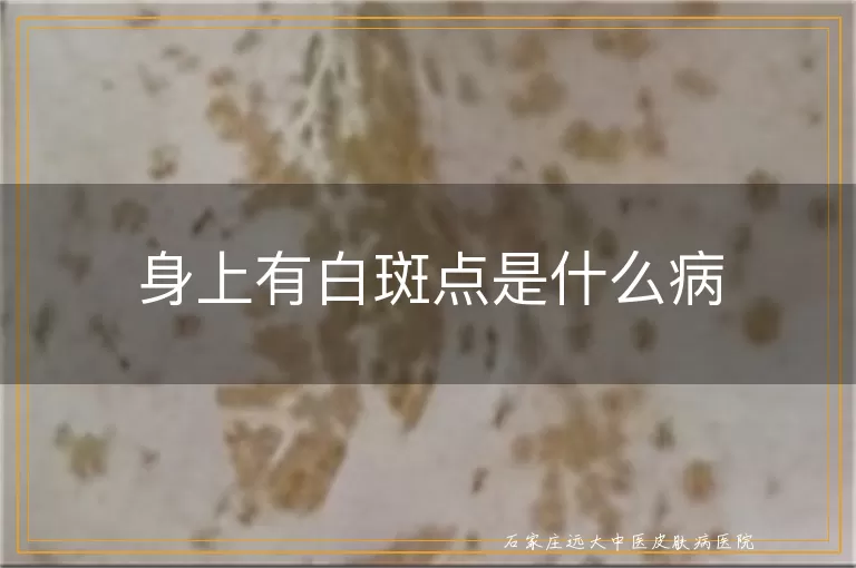 身上有白斑点是什么病