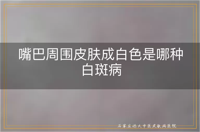嘴巴周围皮肤成白色是哪种白斑病