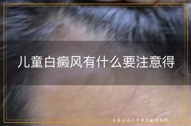 儿童白癜风有什么要注意得