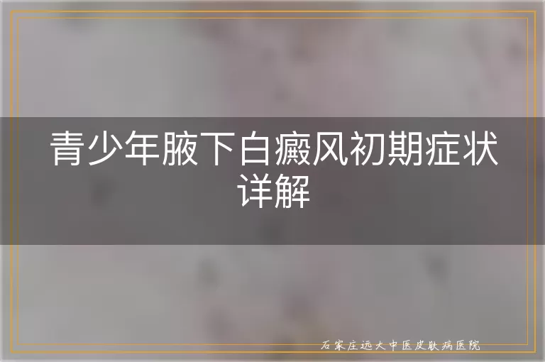 青少年腋下白癜风初期症状详解