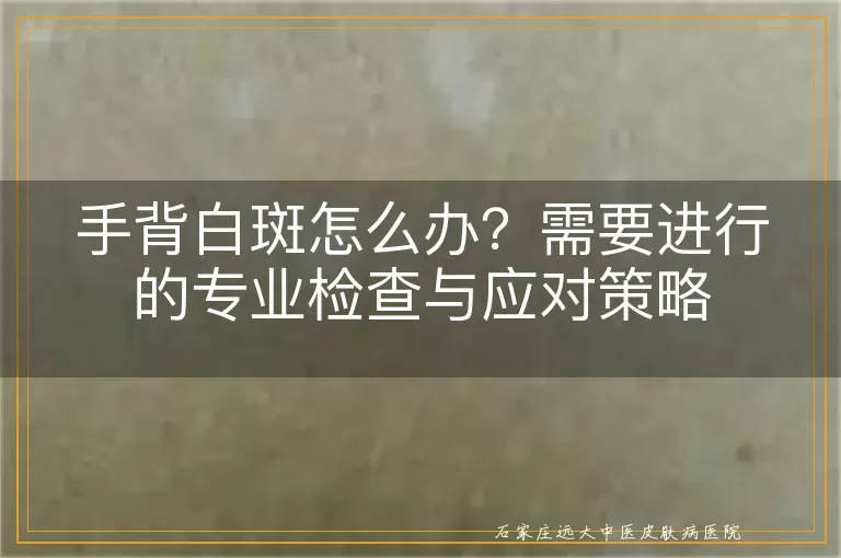 手背白斑怎么办？需要进行的专业检查与应对策略
