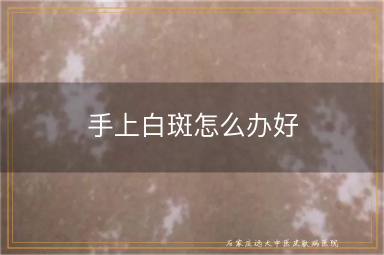 手上白斑怎么办好