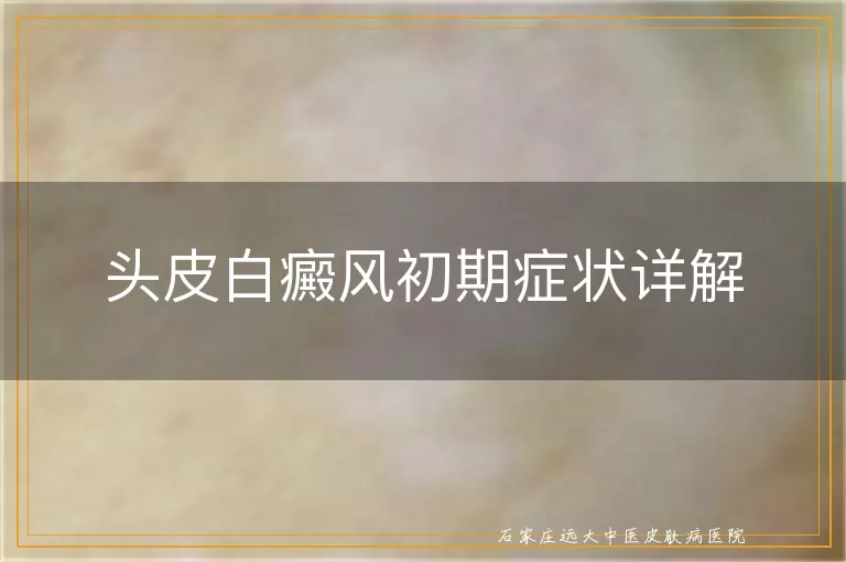 头皮白癜风初期症状详解