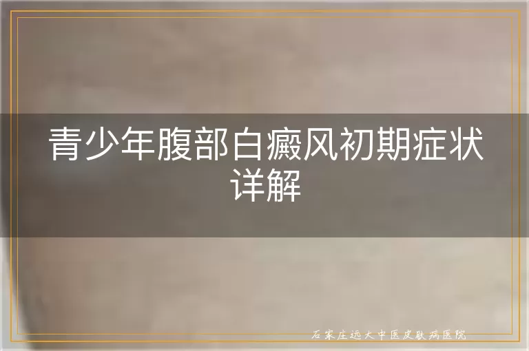青少年腹部白癜风初期症状详解