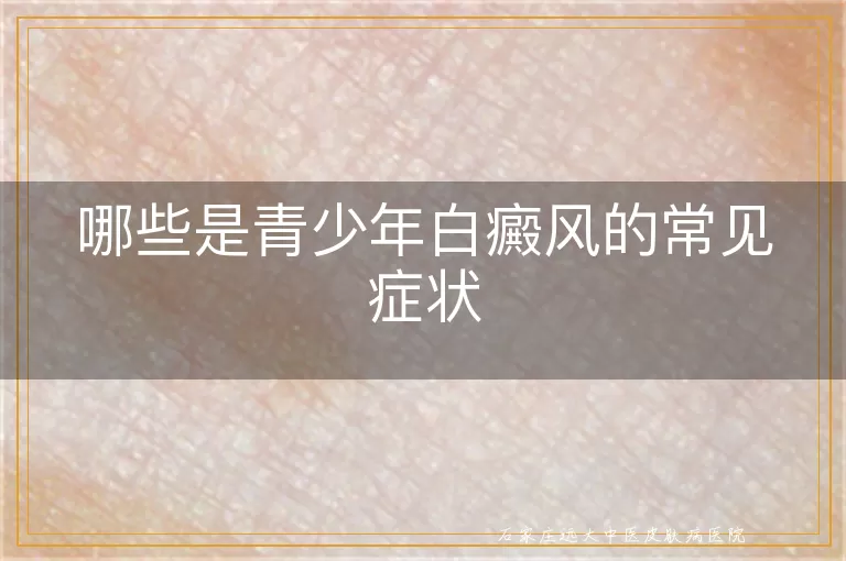 哪些是青少年白癜风的常见症状