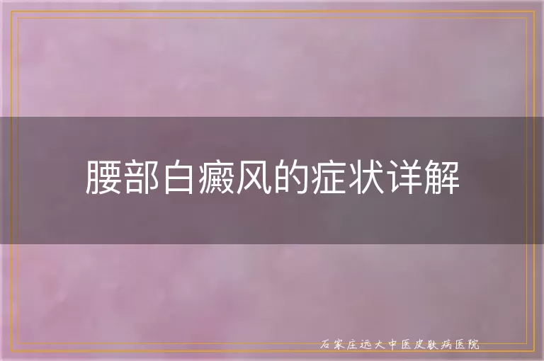 腰部白癜风的症状详解
