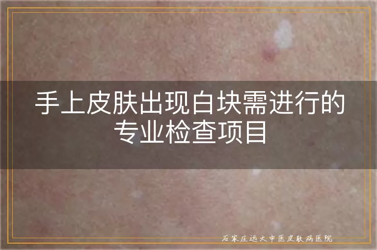 手上皮肤出现白块需进行的专业检查项目