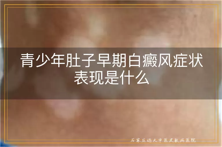 青少年肚子早期白癜风症状表现是什么
