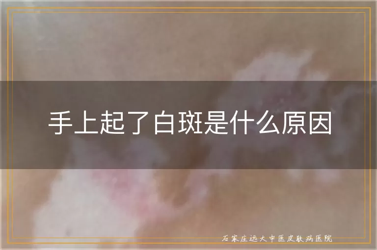 手上起了白斑是什么原因