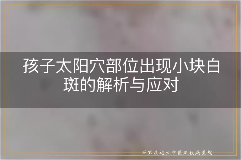 孩子太阳穴部位出现小块白斑的解析与应对