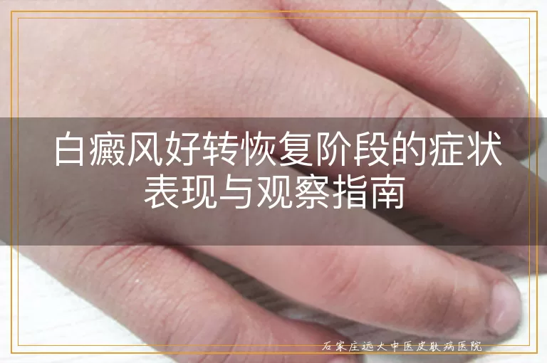 白癜风好转恢复阶段的症状表现与观察指南