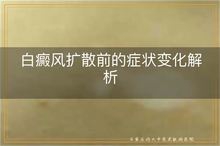 白癜风扩散前的症状变化解析