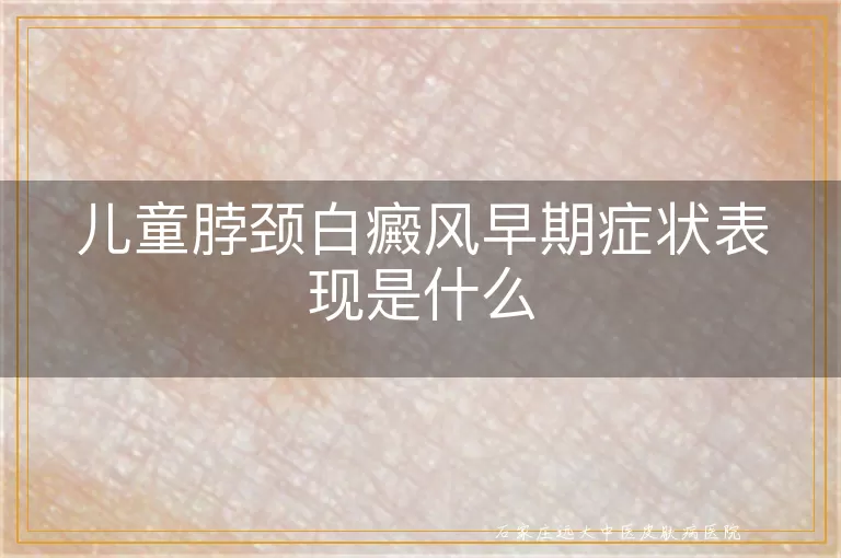 儿童脖颈白癜风早期症状表现是什么