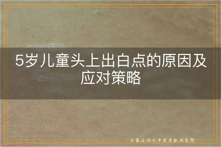 5岁儿童头上出白点的原因及应对策略