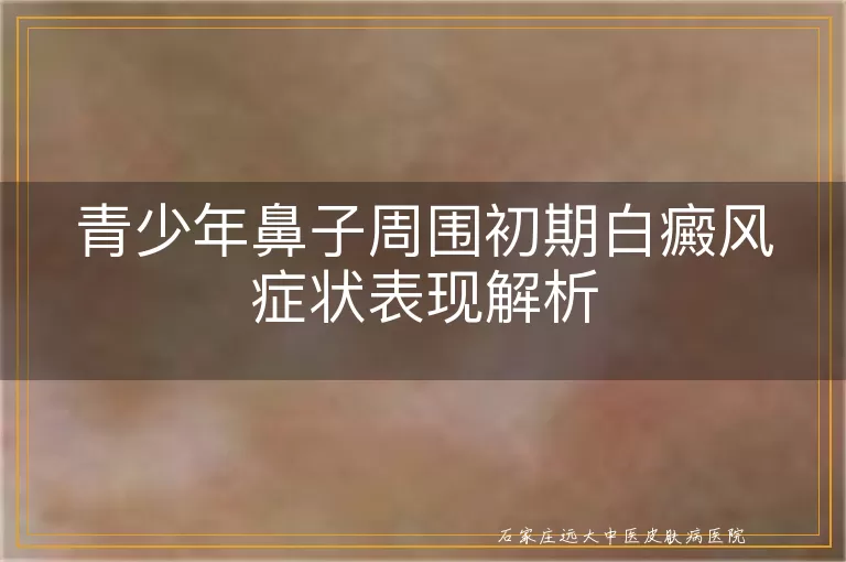 青少年鼻子周围初期白癜风症状表现解析