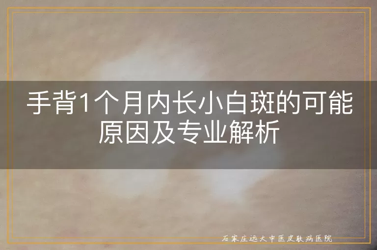 手背1个月内长小白斑的可能原因及专业解析
