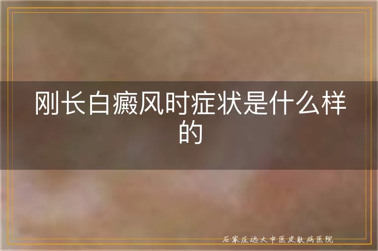 刚长白癜风时症状是什么样的