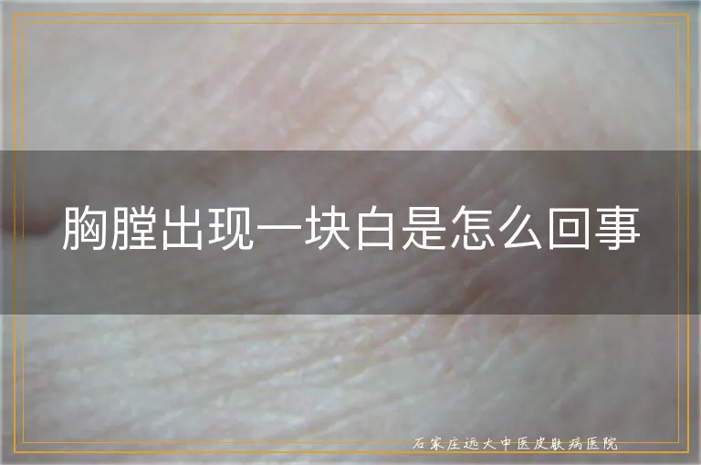 胸膛出现一块白是怎么回事