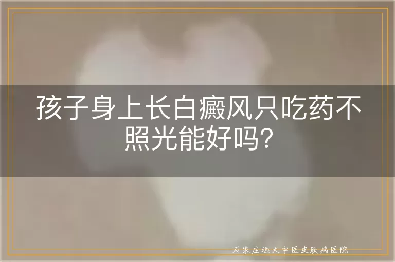 孩子身上长白癜风只吃药不照光能好吗？