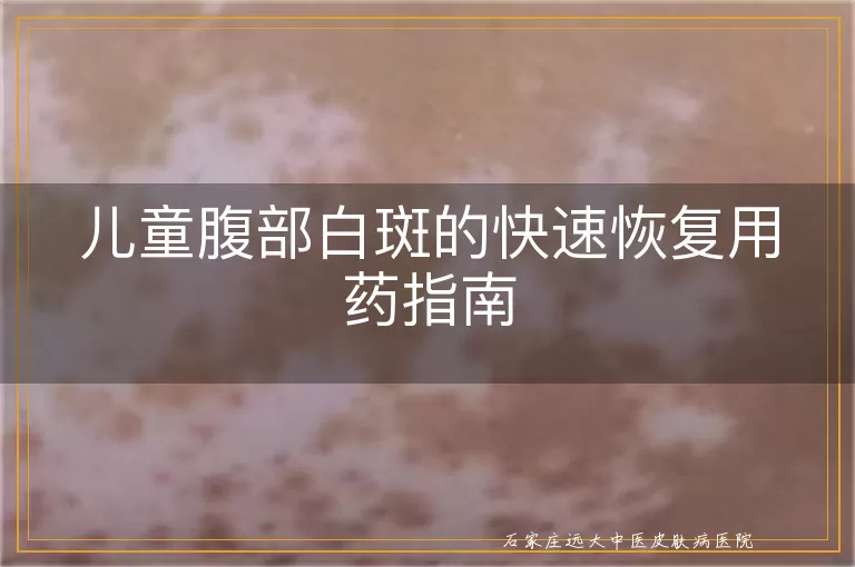 儿童腹部白斑的快速恢复用药指南