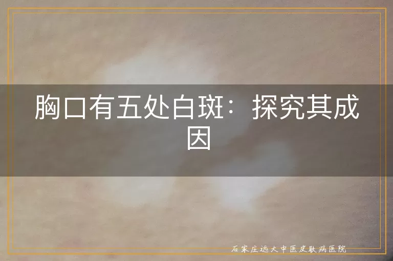 胸口有五处白斑：探究其成因
