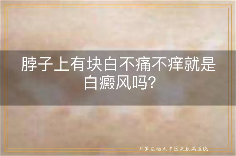 脖子上有块白不痛不痒就是白癜风吗？