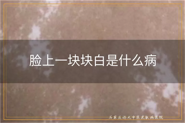 脸上一块块白是什么病