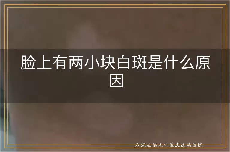脸上有两小块白斑是什么原因