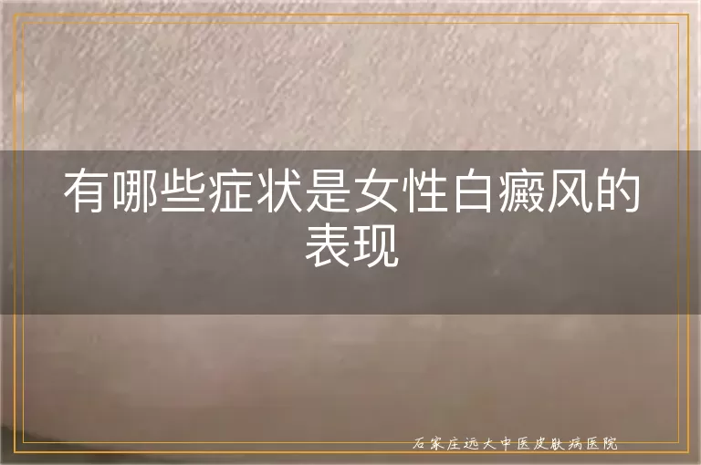有哪些症状是女性白癜风的表现