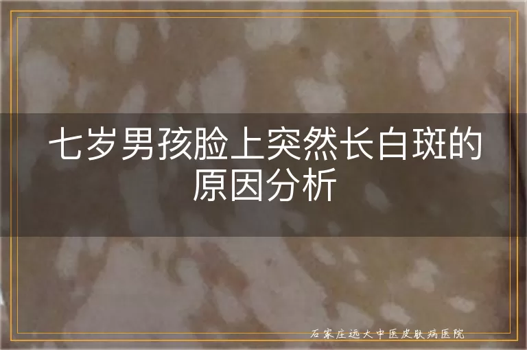 七岁男孩脸上突然长白斑的原因分析