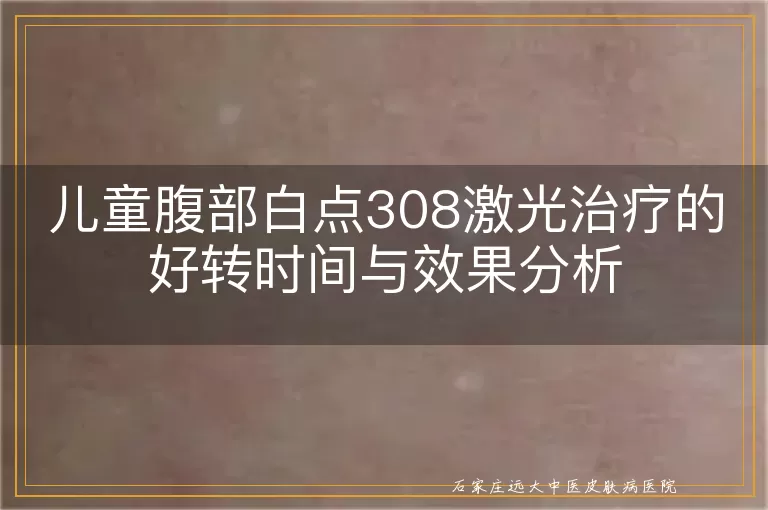 儿童腹部白点308激光治疗的好转时间与效果分析