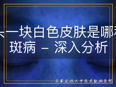 额头一块白色皮肤是哪种白斑病 - 深入分析
