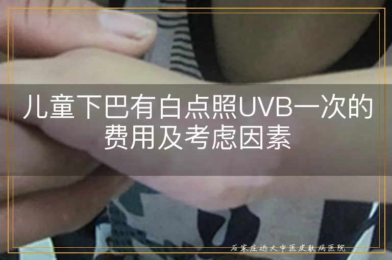 儿童下巴有白点照UVB一次的费用及考虑因素
