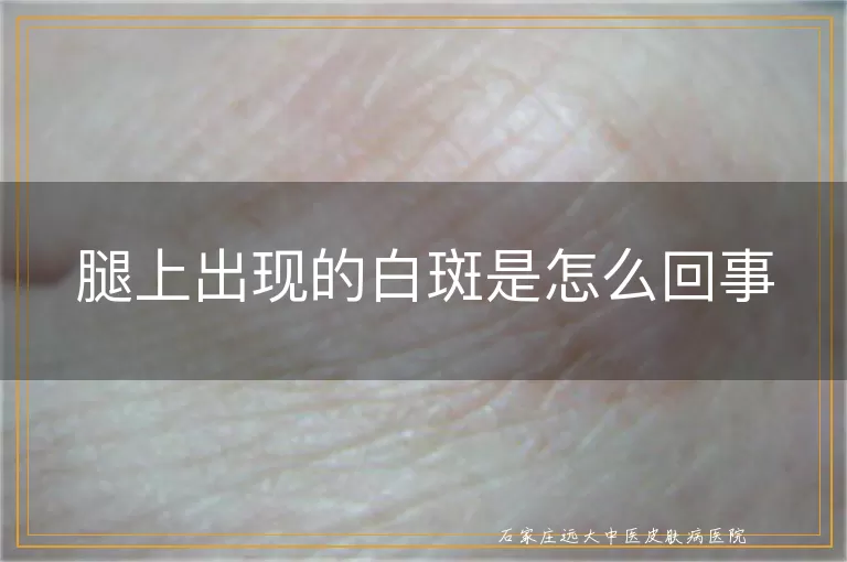 腿上出现的白斑是怎么回事