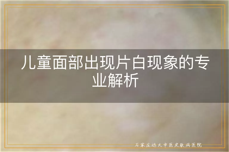 儿童面部出现片白现象的专业解析