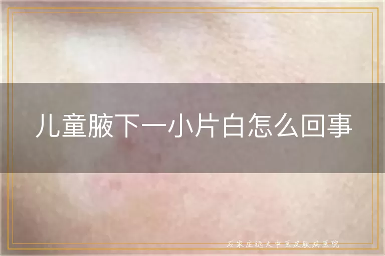 儿童腋下一小片白怎么回事