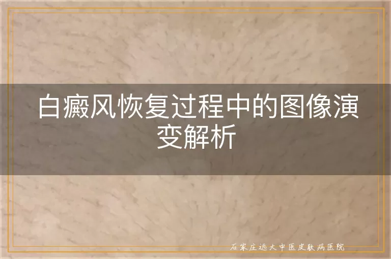白癜风恢复过程中的图像演变解析
