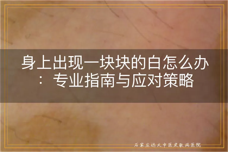 身上出现一块块的白怎么办：专业指南与应对策略