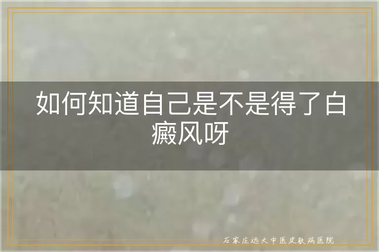 如何知道自己是不是得了白癜风呀