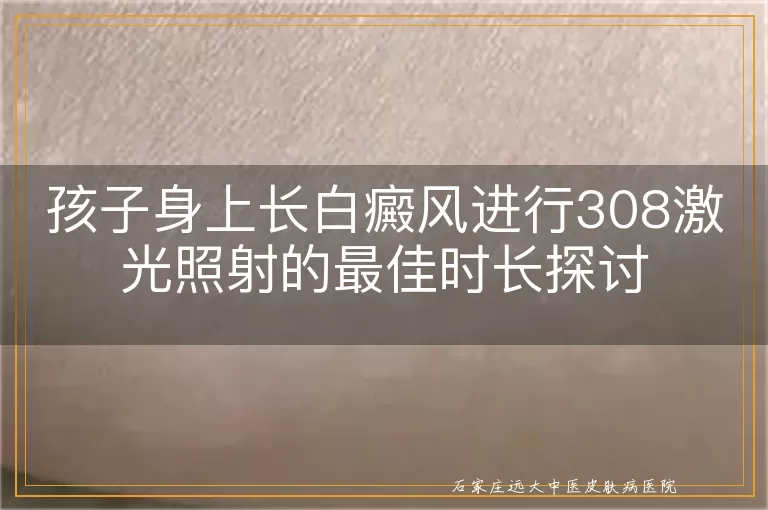 孩子身上长白癜风进行308激光照射的最佳时长探讨