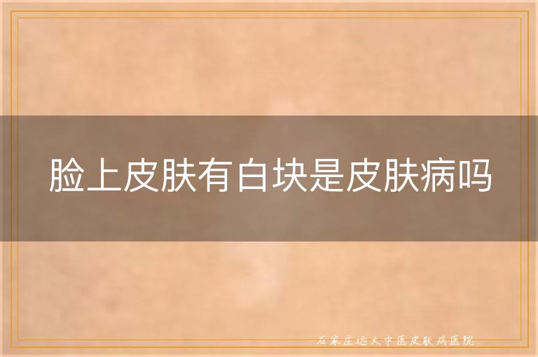 脸上皮肤有白块是皮肤病吗