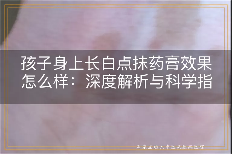 孩子身上长白点抹药膏效果怎么样：深度解析与科学指导
