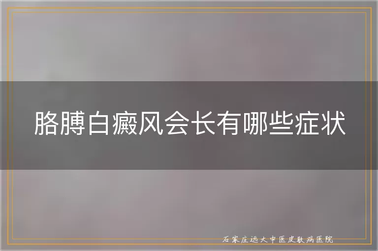 胳膊白癜风会长有哪些症状