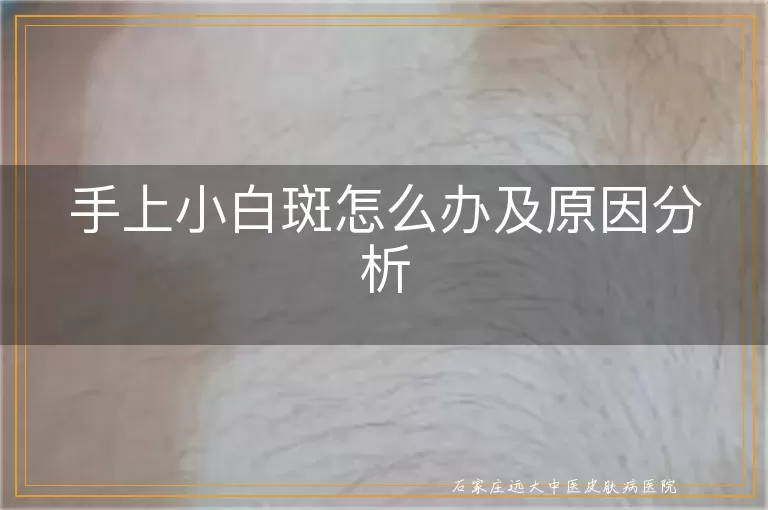 手上小白斑怎么办及原因分析