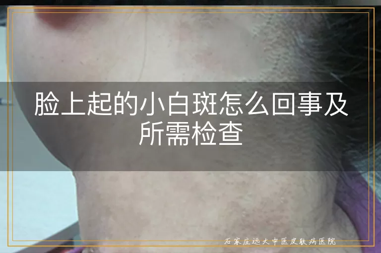 脸上起的小白斑怎么回事及所需检查